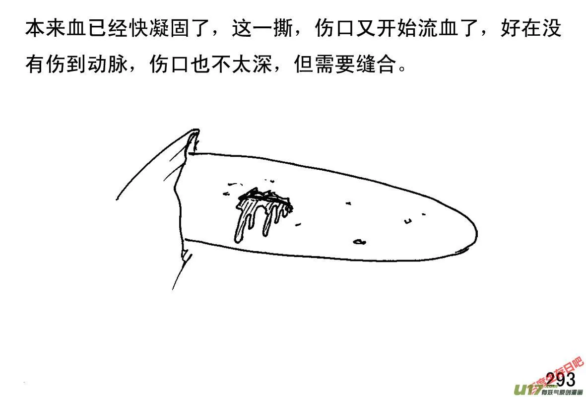 生存日记第四季合集漫画,（第一季）27疗伤3图
