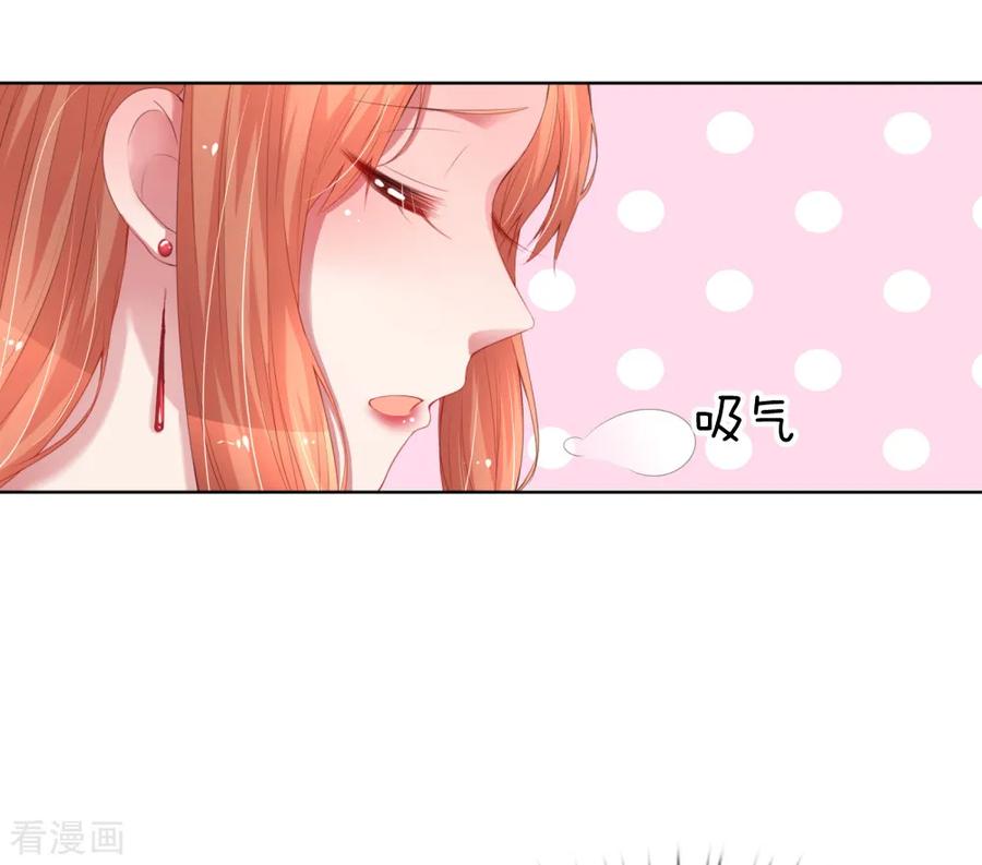 妈咪快跑爹地追来了漫画下拉式奇漫屋漫画,第17话 意外坠马4图